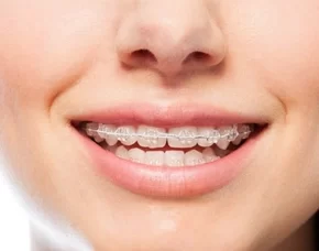 Orthodentistry Orthodentistry